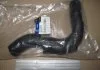 Патрубок системы охлаждения_TUCSON 07-09 / SPORTAGE 05-10 / TUCSON 04-06 MOBIS 254112E350 (фото 2)