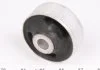 Сайлентблок важеля AUDI A1, A3, SEAT IBIZA IV, VW GOLF IV 96 перед. міст низ (Вир-во) MEYLE 100 407 0043 (фото 3)