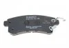 Тормозные колодки дисковые NISSAN/INFINITI Patrol/QX56 \'\'R BOSCH 0986494778 (фото 4)
