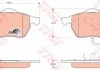 Комплект тормозных колодок переднего., FORD GALAXY I, GALAXY MK I FORD USA FOCUS, FOCUS ZX3, FOCUS ZX5 SEAT ALHAMBRA VW SHARAN 1.8-2.8 03.95-03.10 TRW GDB1440 (фото 1)