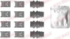 Монтажний компл.,гальм.колодки QUICK BRAKE 1090110 (фото 1)